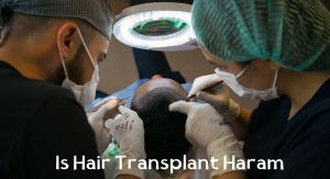 Is Hair Transplant Haram Is Hair Transplant Haram